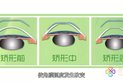 1.什么是角膜塑形镜





02:34



											1.什么是角膜塑形镜, 视频播放量 1548、弹幕量 2、点赞数 8、投硬币枚数 2、收藏人数 7、转发人数 8, 视频作者 泓睿暖阳文化传播, 作者简介 健康最暖...
										
哔哩哔哩
2021-09-16 18:19