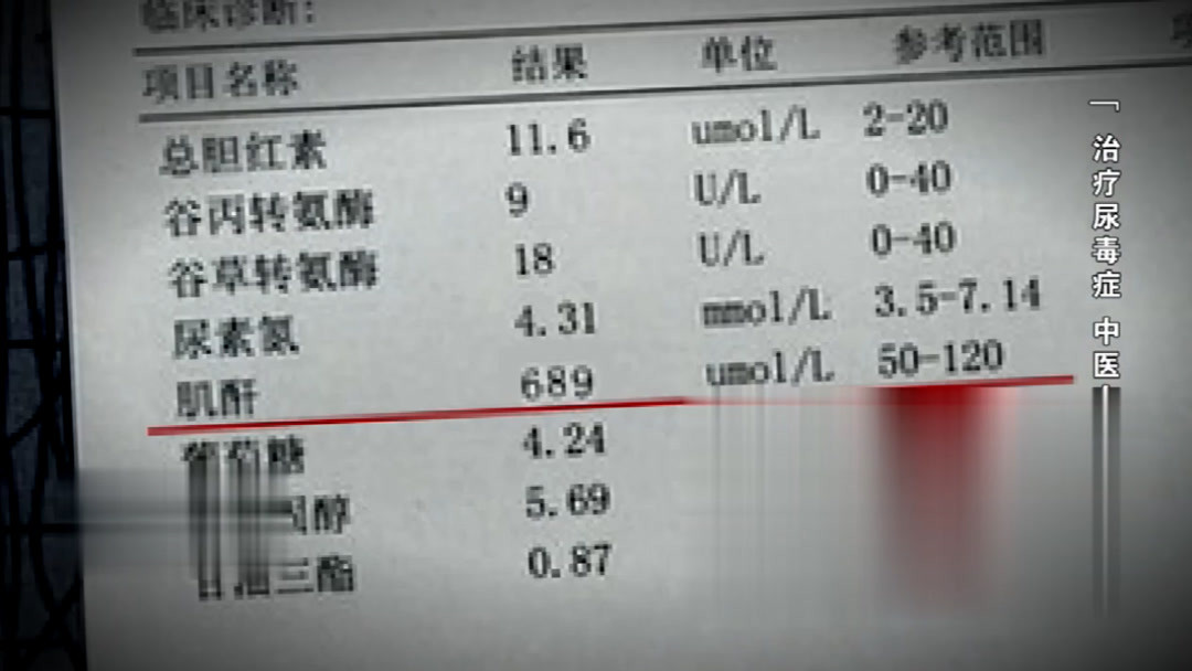 肌肝600怎么治疗(01/31更新)