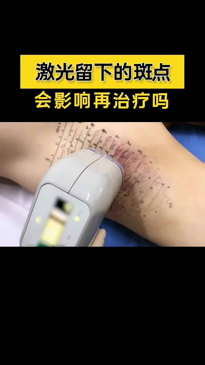 怎么用刀治疗腋臭最有效