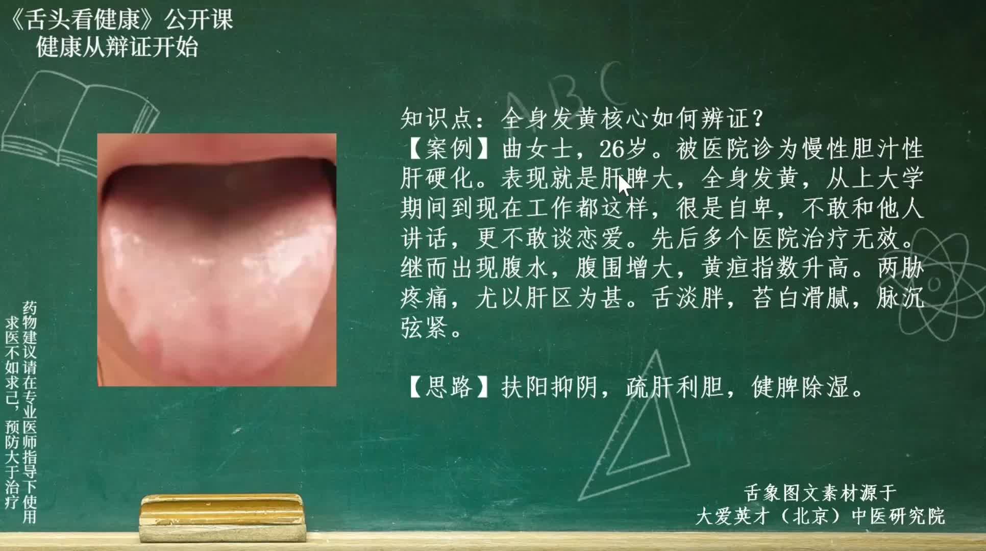 全身有点发黄吃什么药好