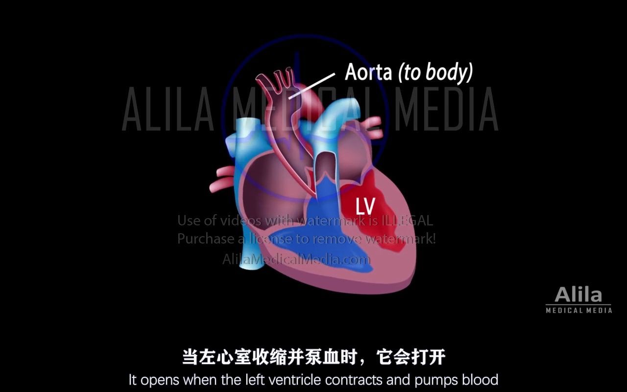 腹腔动脉狭窄怎样治疗(腹主动脉狭窄怎么办)