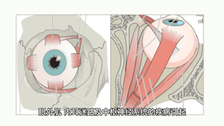 眼颤是怎么回事？