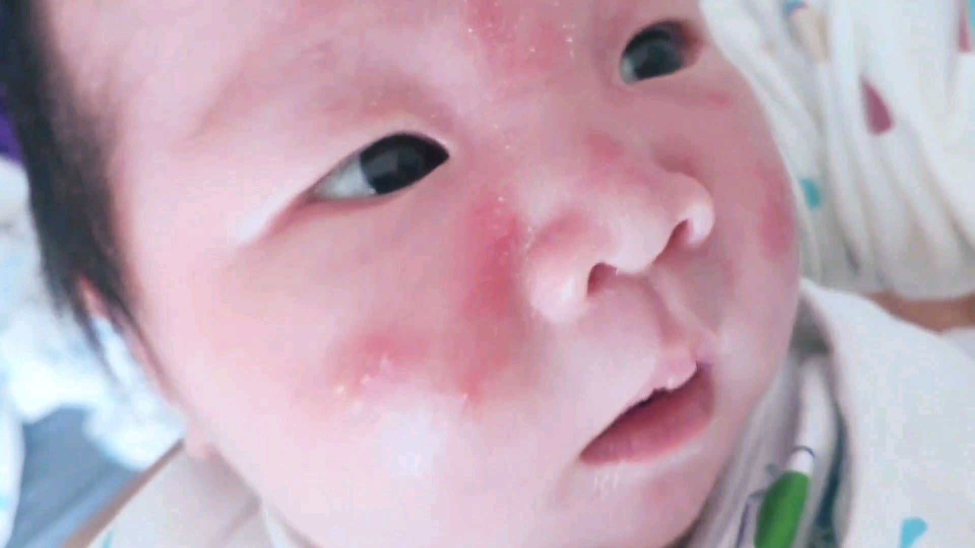 怎样小痘痘