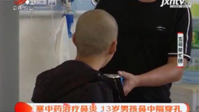 肠穿孔中药怎样治疗(01/20)