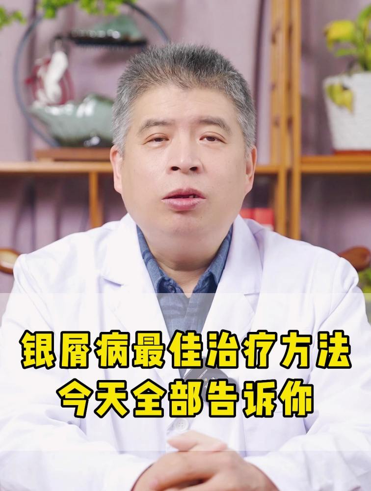 治疗银屑病最好的方法(01/19)