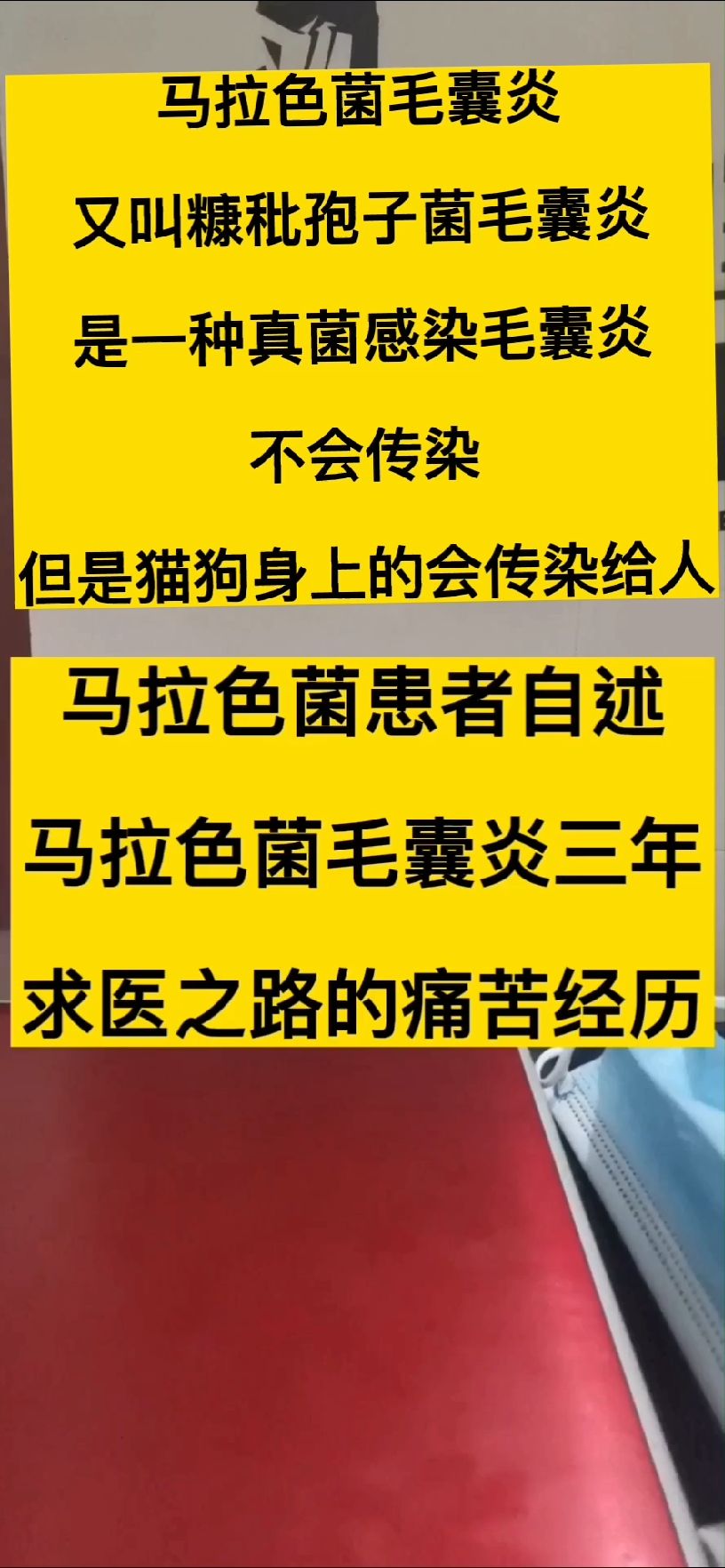 糠秕孢子菌性毛囊炎会传染吗?