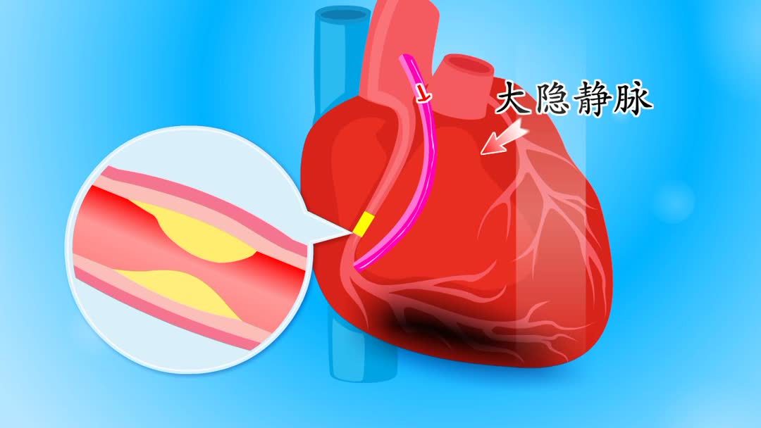 先天性心脏病免费治疗吗(先天性心脏病国家现在是不是给免费治疗？)