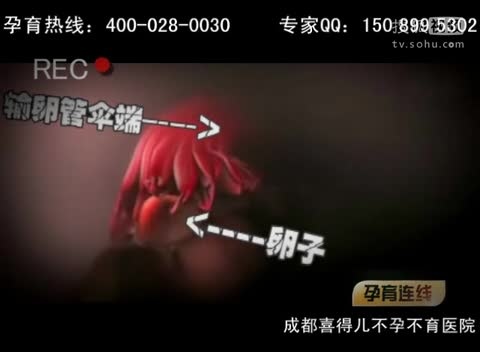 治疗男女不育不孕最好的医院是哪一家