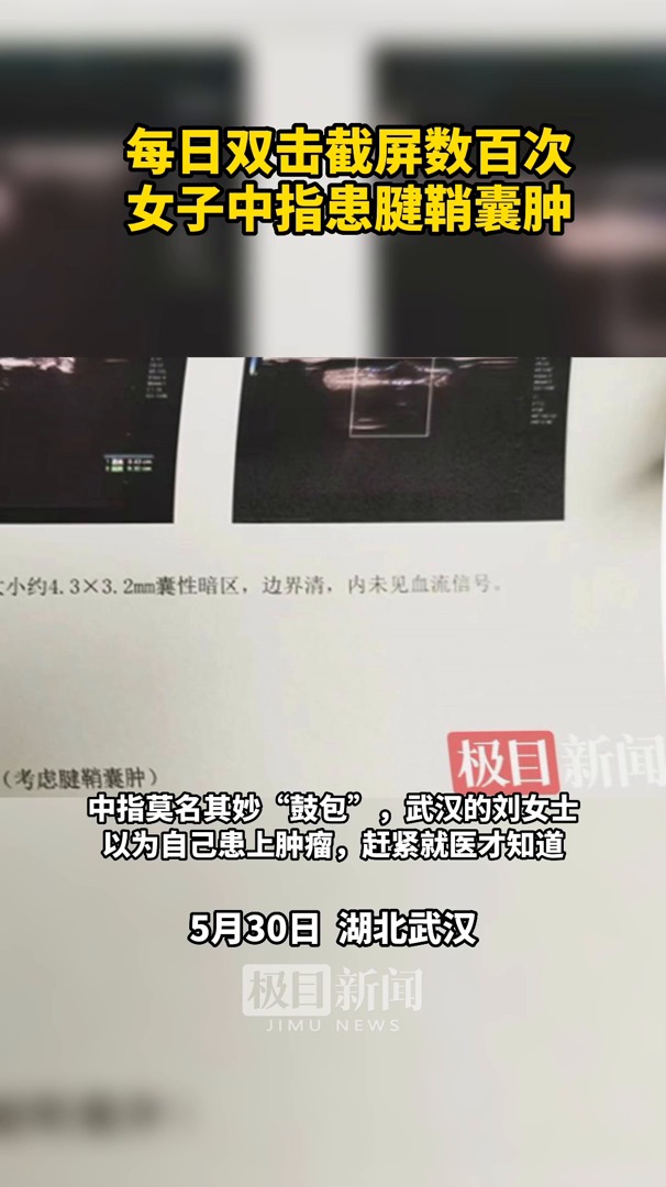 中指腱鞘囊肿怎样治疗(广东岭南职业技术学院的学费是多少啊？)