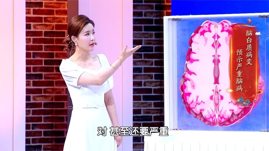 脑白质病变能活多久(06/30更新)