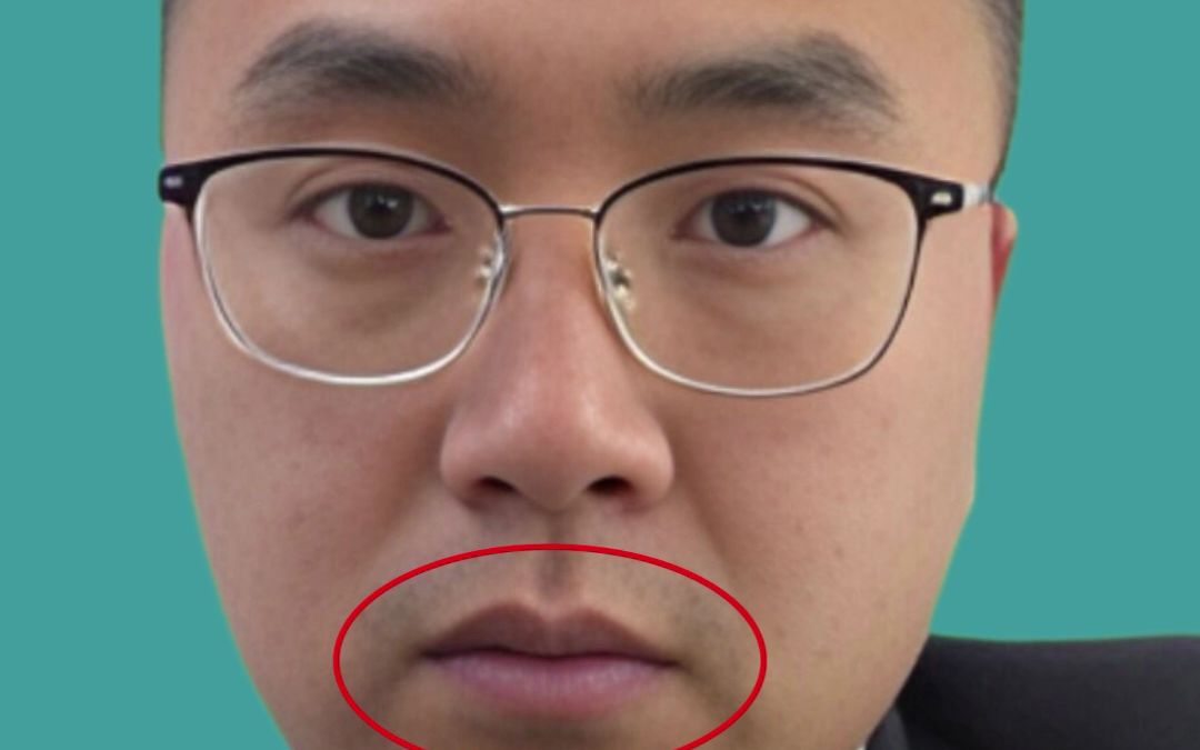 鼻梁右侧有痣代表什么