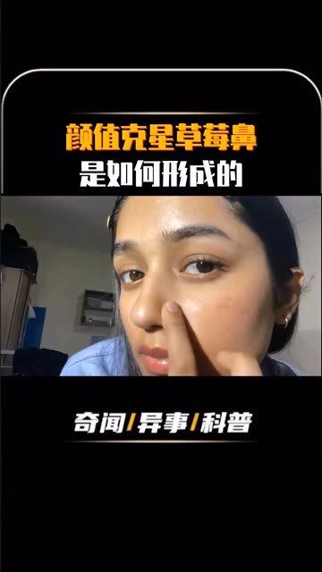 鼻子草莓鼻如何治疗