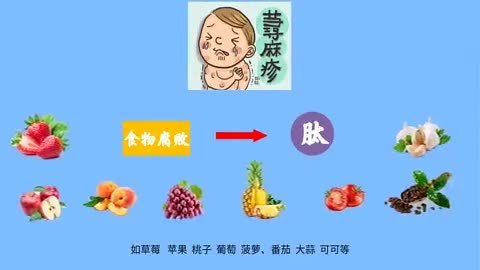 小孩得了风疹怎么办(01/19)