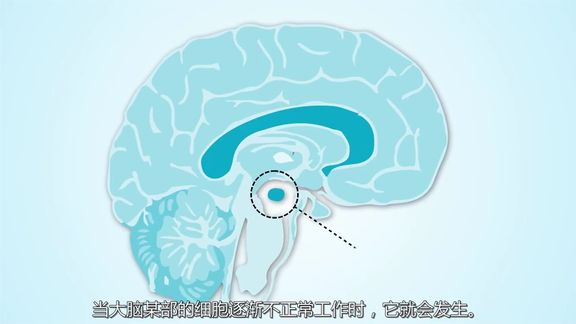什么是帕金森病?