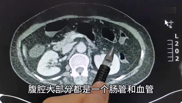 腹腔淋巴怎样治疗方法(小儿腹腔淋巴结略大的治疗方法)