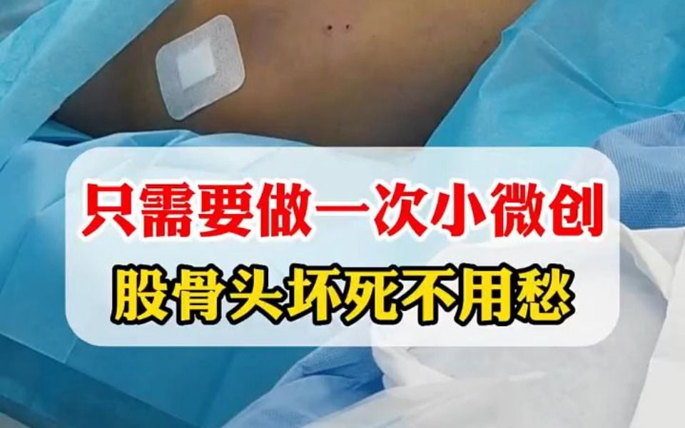 微创治疗股骨头坏死有效果吗