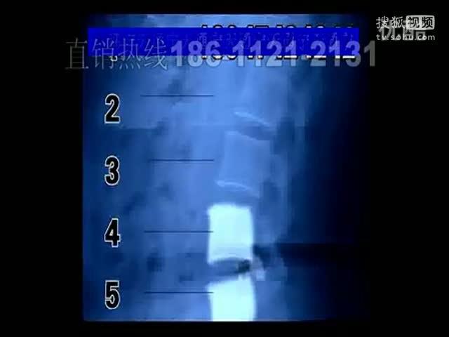 舒筋活络丸价格