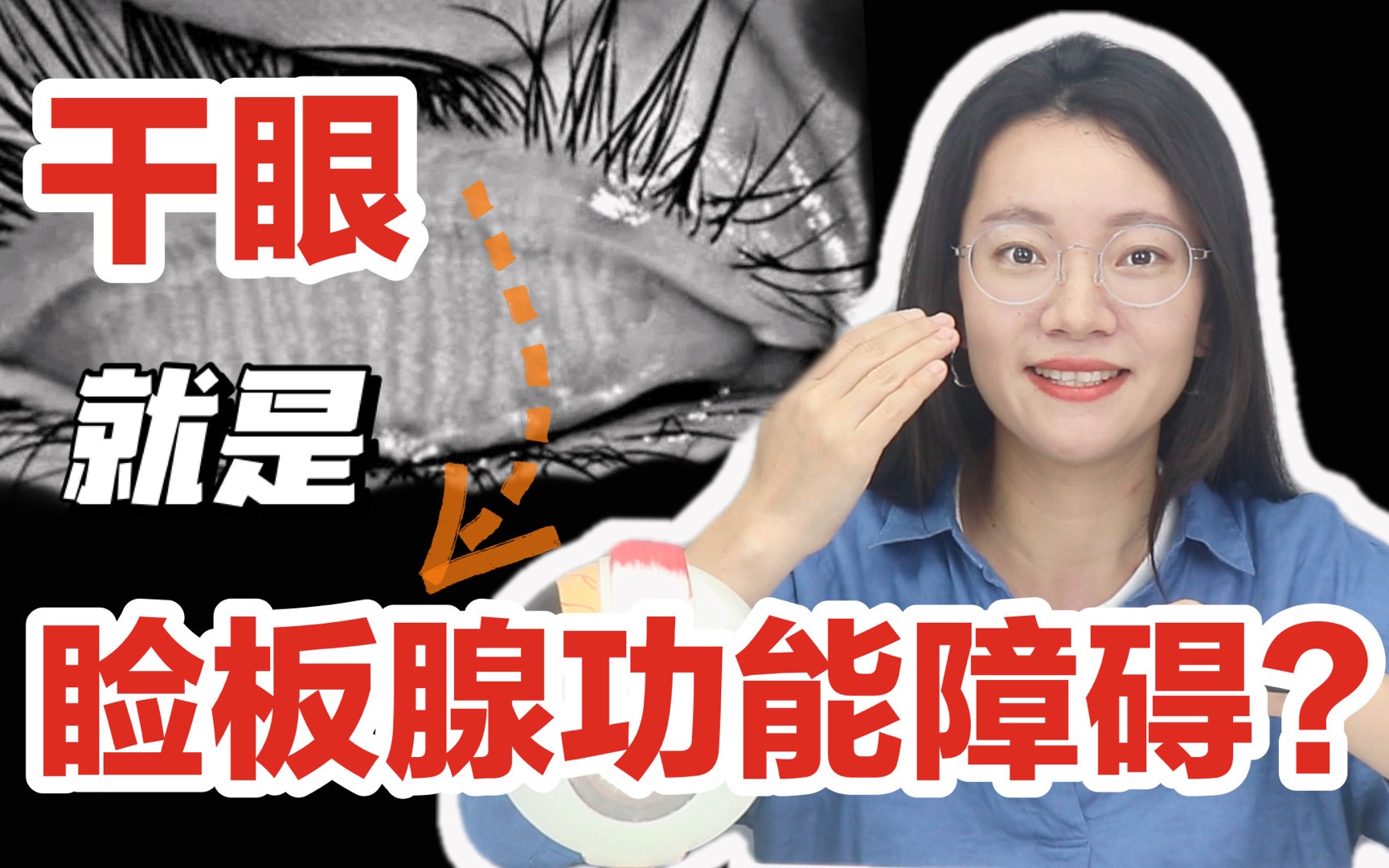 眼腺管堵塞怎么治疗(六个月的宝宝泪腺堵塞，又不吃药怎么办)