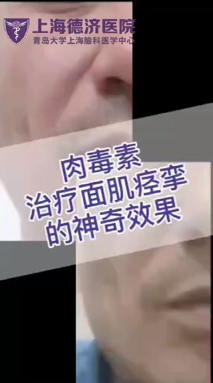 肌肉经软痛苦怎么治疗(怎么消除肌肉酸痛？)