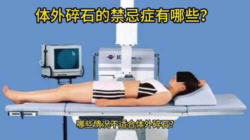 体外碎石要多少钱(07/06更新)