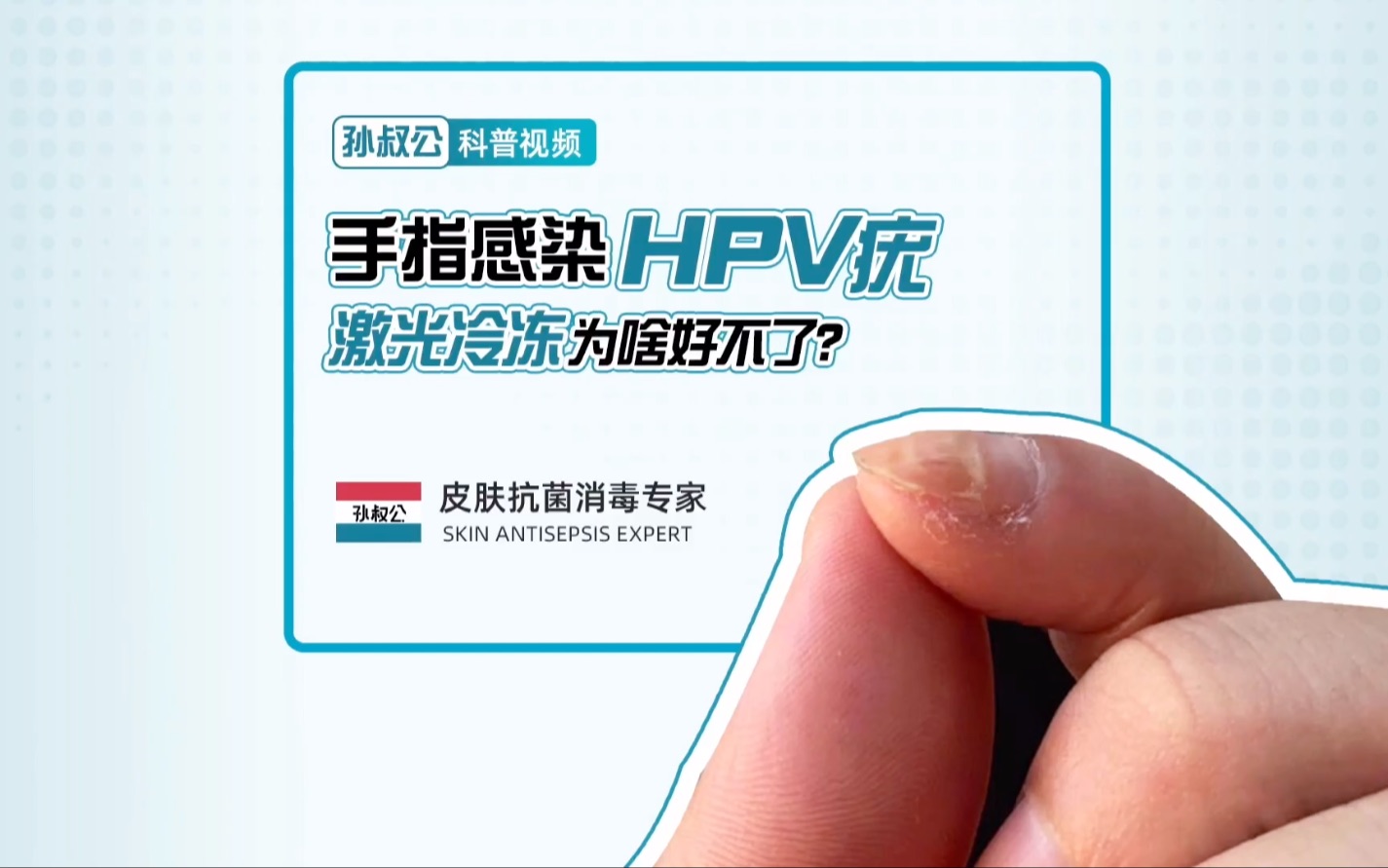 跖疣使用激光还是冷冻好，需要多少钱