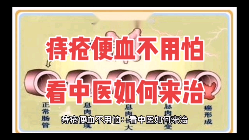 痔疮便血怎么治疗？