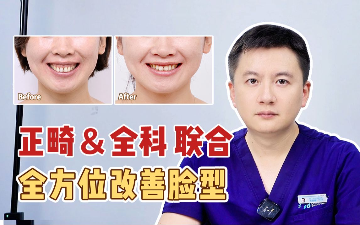 四环素牙如何治疗