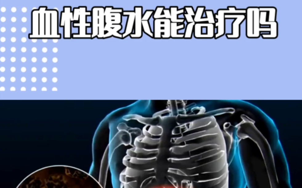 什么是血性腹水(狗狗腹水抽出是血水？)