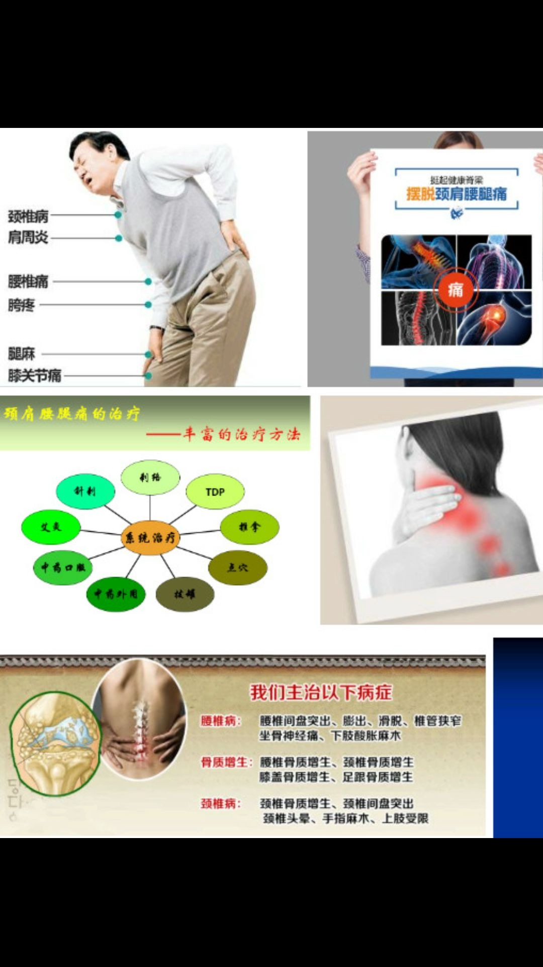 腰部引起腿浮肿怎么治疗