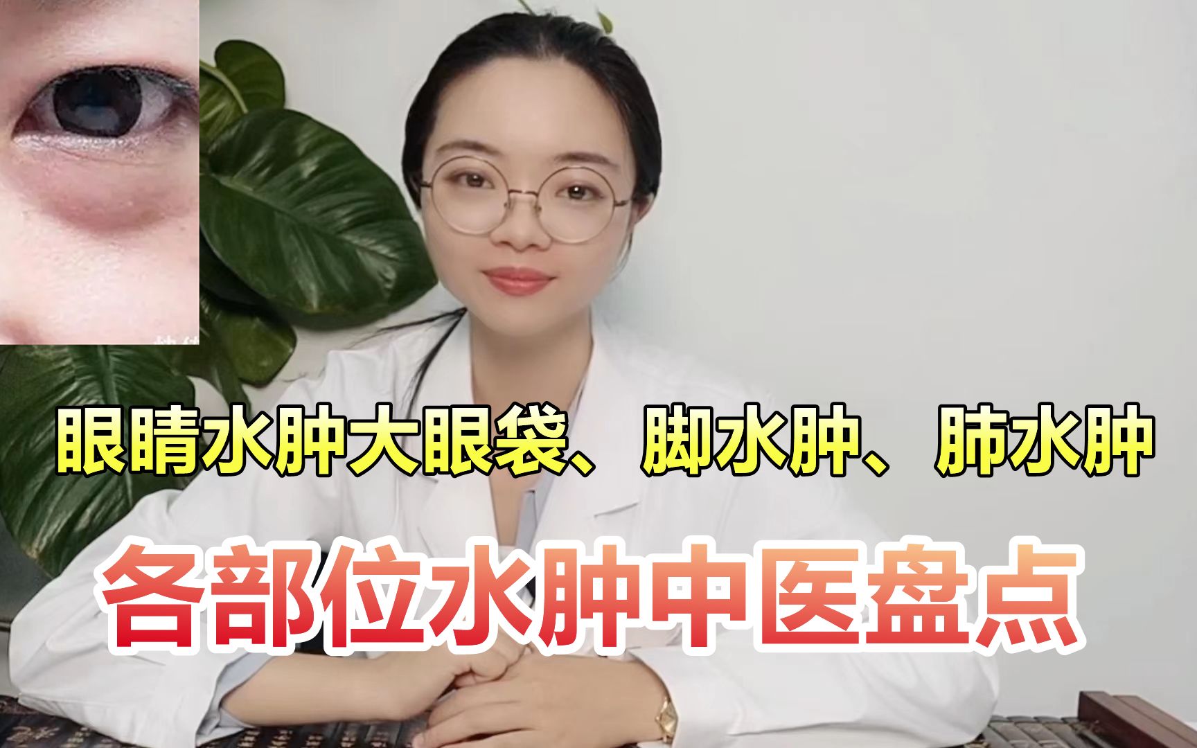 水肿吃什么药(01/10)