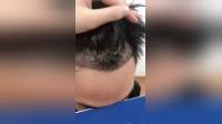 植发加盟需要什么条件