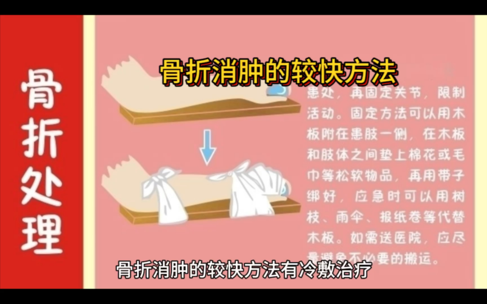 骨折后有哪些消肿方法