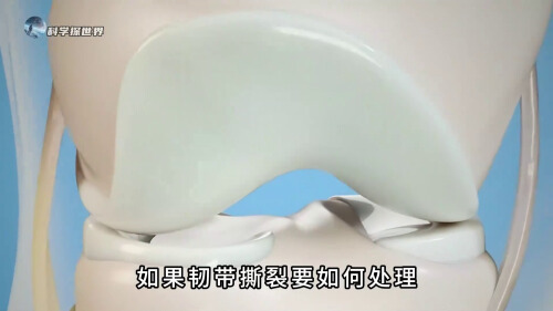 韧带撕裂用什么药